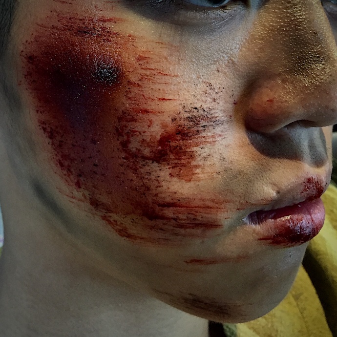 十分钟即兴小伤效