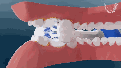 实效三维动画展示，助电动牙刷品牌渗透市场份额